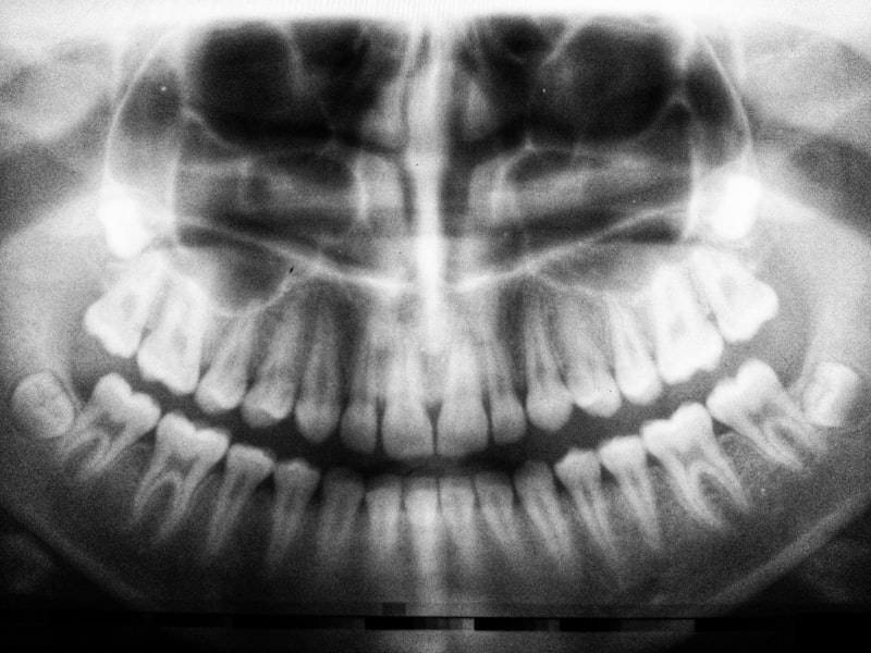 Pianificazione implantare 3D